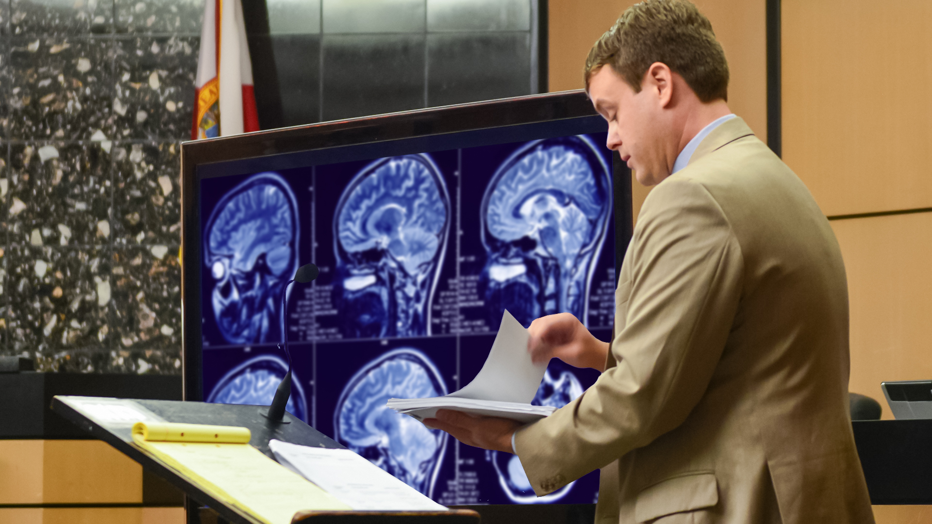 Brain Injuries